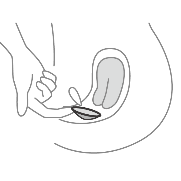 膣口に挿入